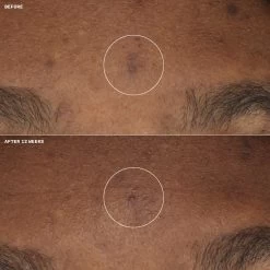 Clinique Even Better Clinical Brightening Moisturizer -Clinique Shop 2604766 alt05