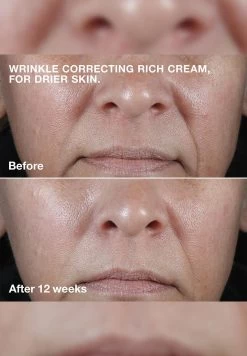 Clinique Smart Clinical Repair™ Wrinkle Correcting Cream Mini 11 Clinique Smart Clinical Repair™ Wrinkle Correcting Cream Mini -Clinique Shop original 171