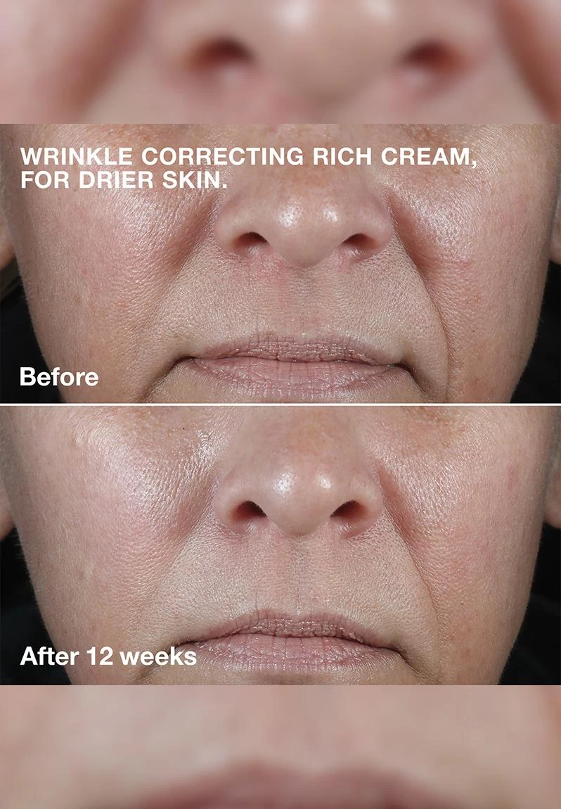 Clinique Smart Clinical Repair™ Wrinkle Correcting Cream Mini 7 Clinique Smart Clinical Repair™ Wrinkle Correcting Cream Mini - Image 5